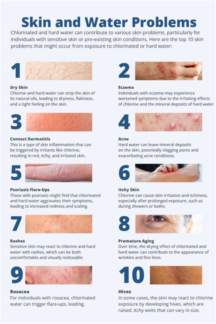 5 Things you MUST do pre and post swimming to combat the effects of chlorine on skin and hair