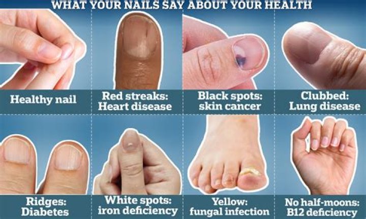 9 Things Pedicurists Wish You Wouldn't Wear To Your Nail Appointments