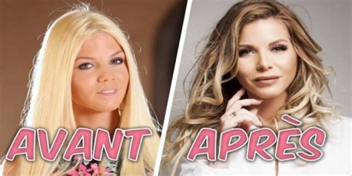 Adixia Avant Chirurgie: 