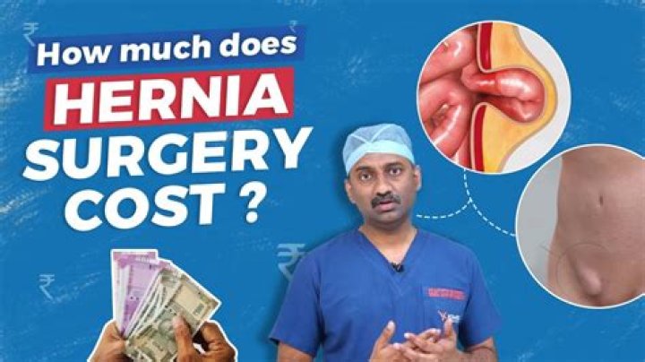 Affordable Hernia Surgery: How to Find the Best Option for You
