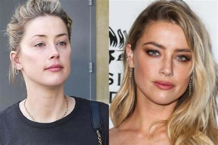 Amber Heard Chirurgie - Bonjour Buzz