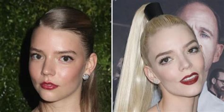 Anya Taylor-Joy's Plastic Surgery: Natural Or Nip-and-Tuck?