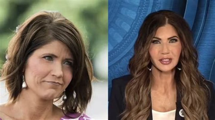 Before and After Pictures of Kyra Sedgwick’s Plastic Surgery, 2023!