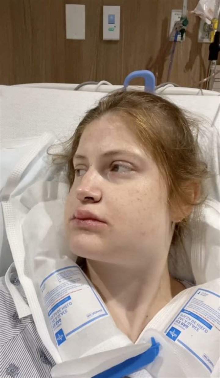 Brielle Biermann shows off her 'side profile' in a new clip after having double jaw surgery & sharing shocking pics
