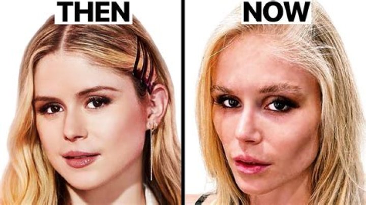 Carrie Underwood's Beauty Routine Is so Effective People Think She's Had Plastic Surgery