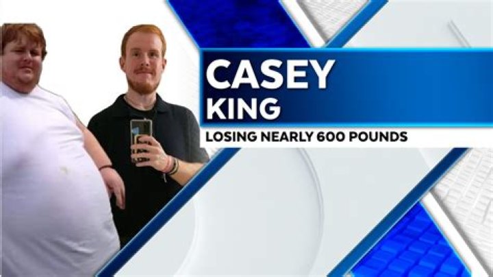 Casey King Weight Loss - An Inspiring Journey of Shedding 600 lbs