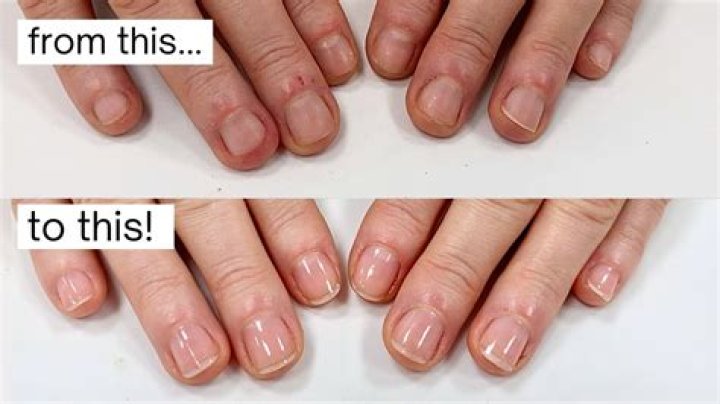 Constant picking at nails/rag nails