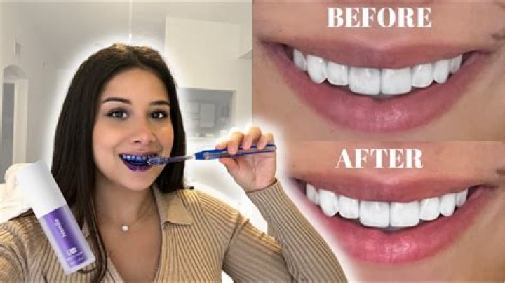 Does Purple Toothpaste Actually Whiten Your Teeth? I Tried It & Here's What You Need To Know