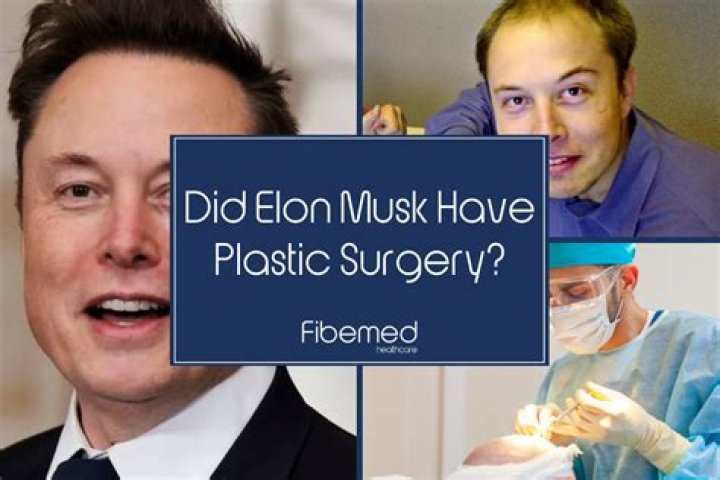 Everything About Elon Musk Plastic Surgery