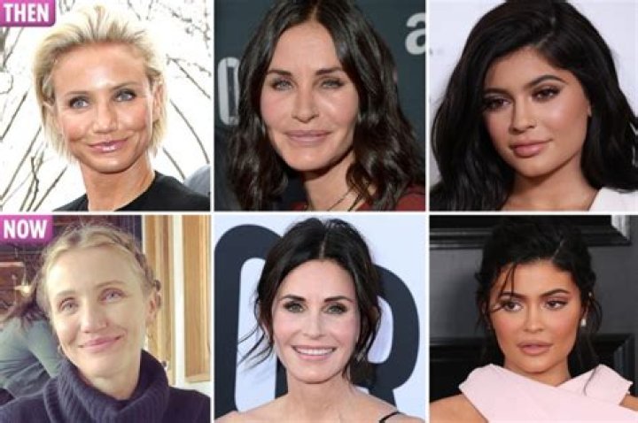 From Kylie Jenner to Cameron Diaz, the stars who are ditching the Botox and embracing a natural look