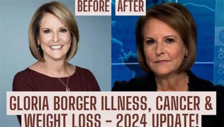 Gloria Borger Weight Loss: Journey To A Healthier Lifestyle