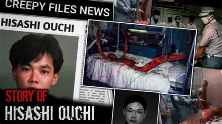 Hisashi Incident Photos Real: Uncovering The Truth Behind The Controversy