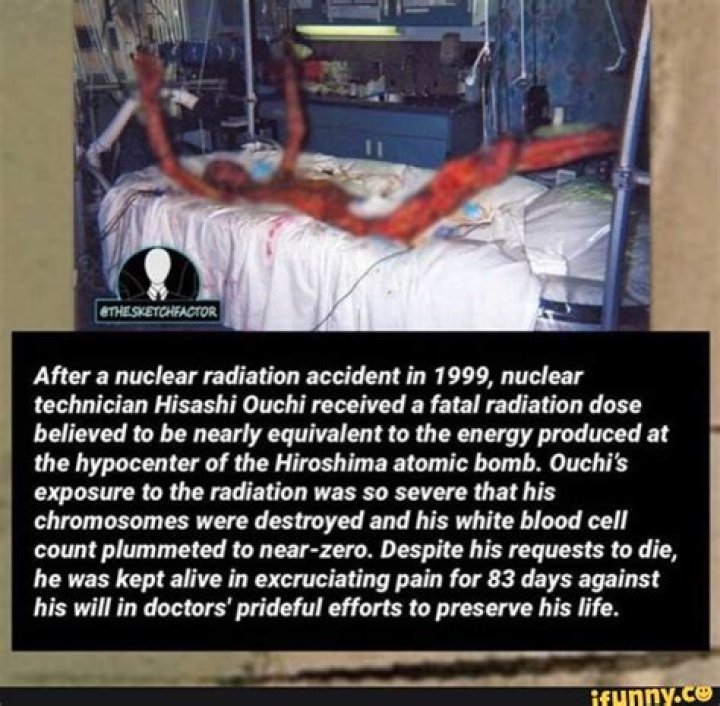 Hisashi Nuclear Accident: Understanding The Tragic Event And Its Impact