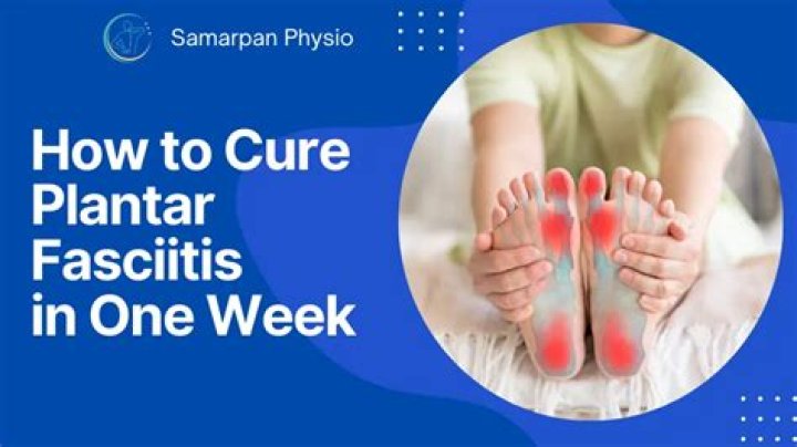 How to Cure Plantar Fasciitis in One Week: MDs’ Top Tips