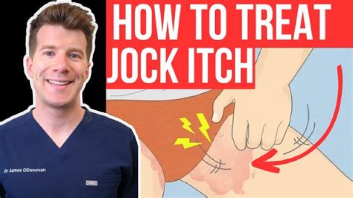 How to Know if You Have Jock Itch