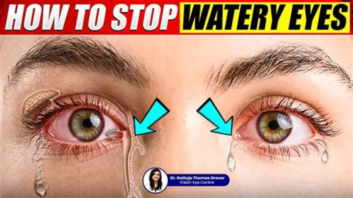 How To Stop Watery Eyes At Home: Can A Viral Hack Work?