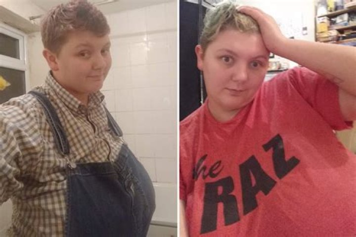 I asked strangers to pay for my breast reduction, after my 36M chest caused such severe back pain I blacked out