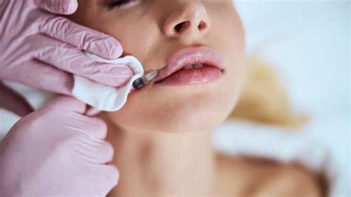I give people Botox professionally - the mistakes people ALWAYS make and why so many people end up with duck lips