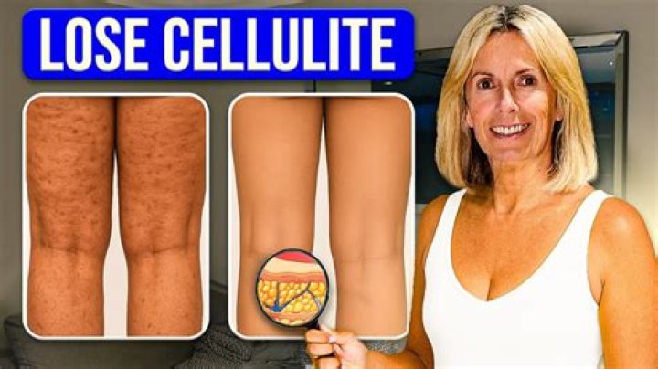 I’m a certified muscle mommy with thigh dimples - cellulite is sexy and you should definitely wear the shorts