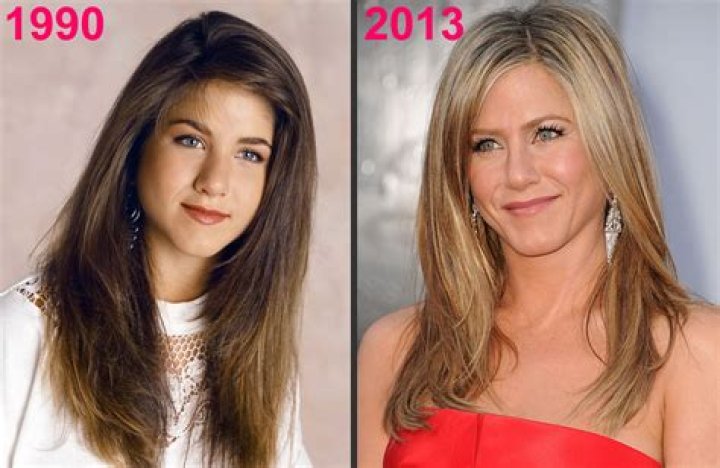 jennifer aniston chirurgie