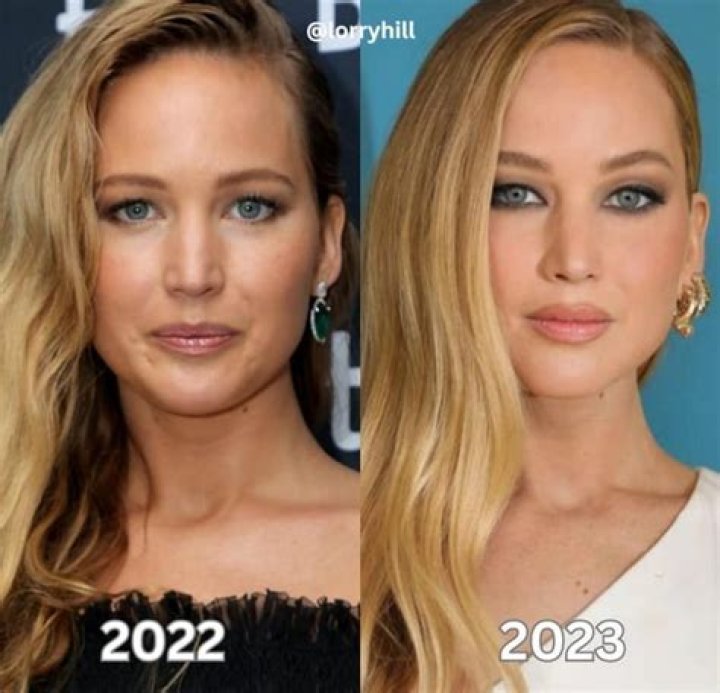 Jennifer Lawrence Chirurgie: 