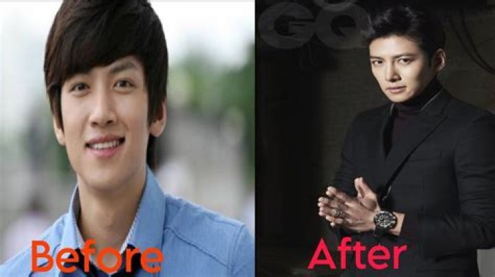 Ji Chang-Wook’s Controversy Surrounding Plastic Surgery