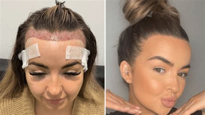 Joe Swash opens up about having a hair transplant for the first time on Loose Women – The Sun
