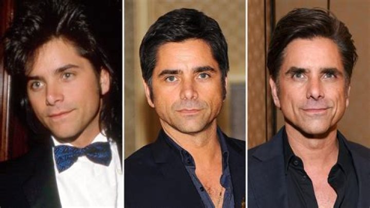 John Stamos’ Plastic Surgery: Why He Did It and How He Looks Now