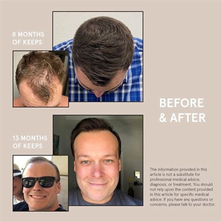 Keeps Hair Loss Treatment Subscriptions Are Up to 60% Off for Cyber Monday