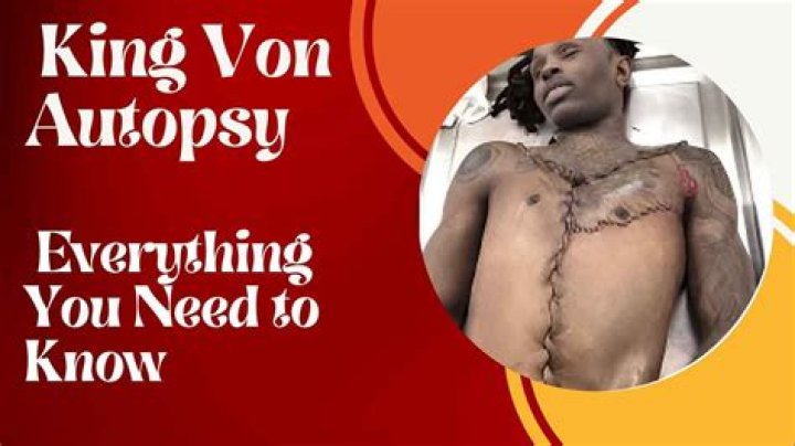 King Von Autopsy Pictures: Understanding The Impact And Controversy