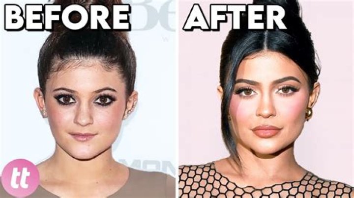 Looks of Camila Morrone after Plastic Surgery