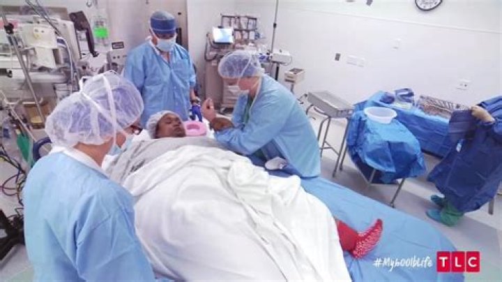 Massively obese woman sheds a staggering 33 STONE and can finally walk again after life-saving surgery