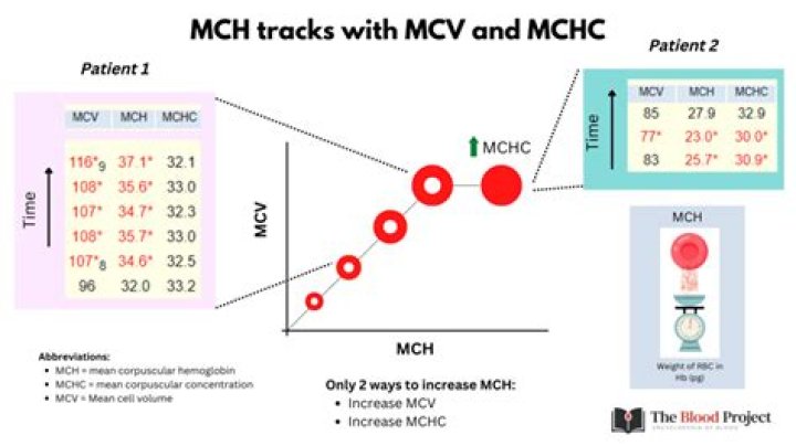 تحليل MCV و MCH منخفض أعراض – تريندات 2024