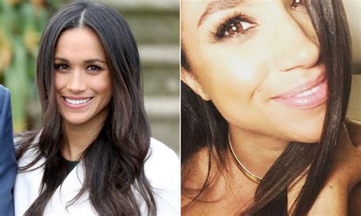 Meghan Markle sparks rise in nose job requests, reveals plastic surgeon