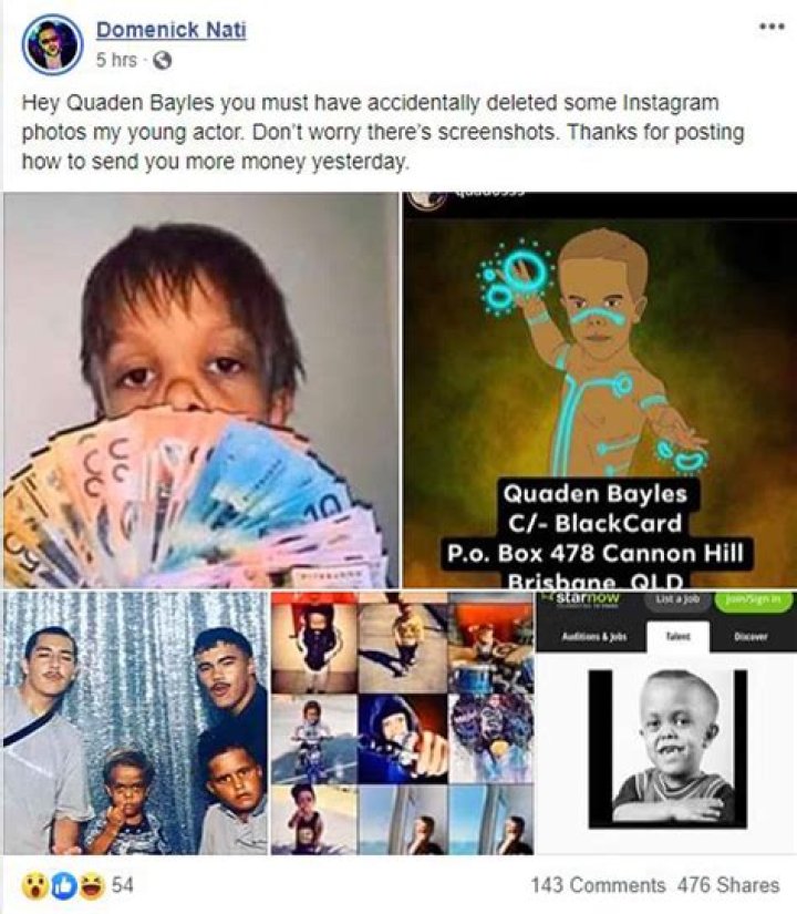 Rumor buster: Quaden Bayles is not 18, as bullied boy gains sympathy from the world
