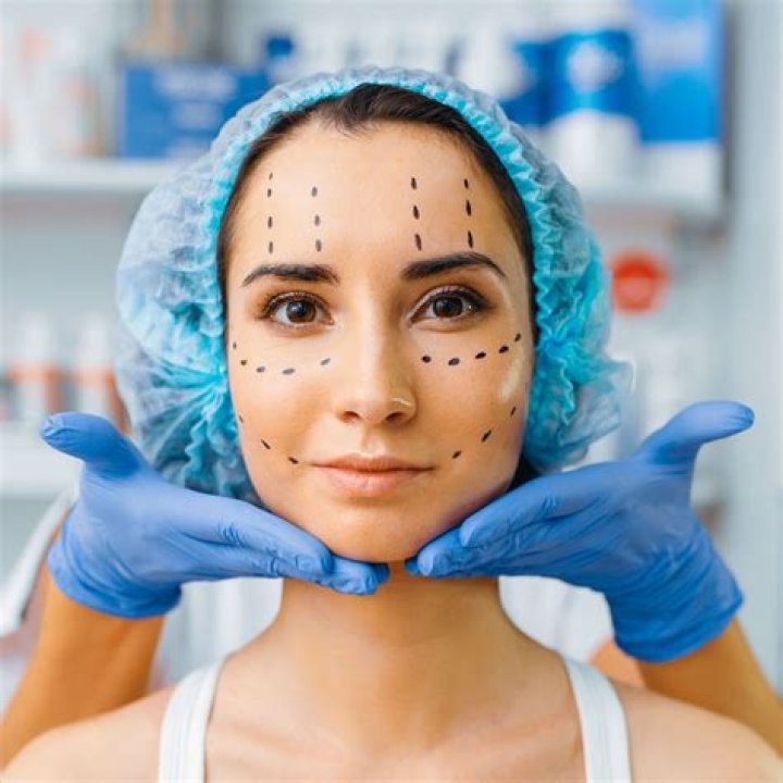 Sheila Chirurgie : La chanteuse a-t-elle eu recours à la chirurgie esthétique ?