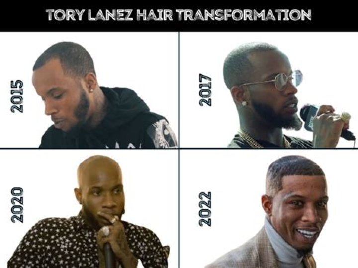 Tory Lanez’s hair sparks mockery on Twitter over ‘bald spot’