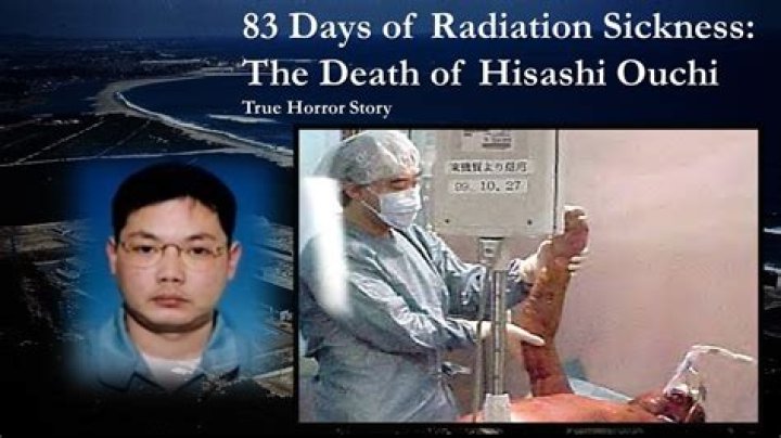 Understanding Hisashi Ouchi: The Radiation Image And Its Implications