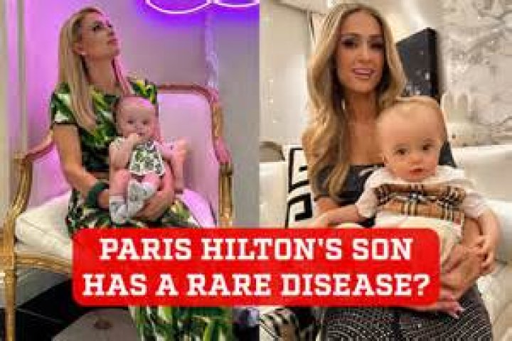 Understanding Paris Hilton's Son: Condition And Insights