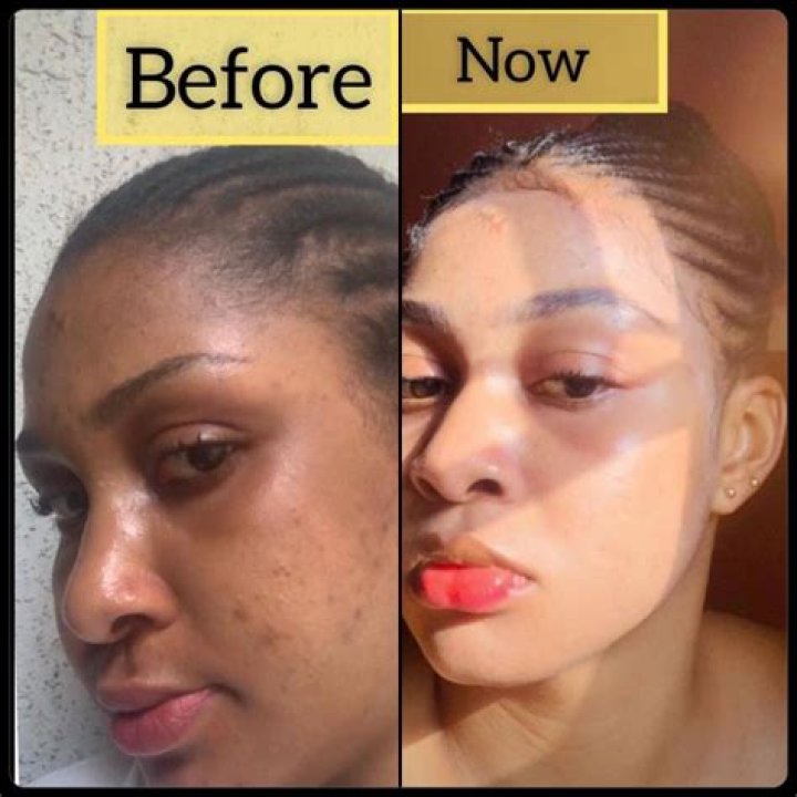 Vybz Kartel Slammed for Bleaching Skin After He Gets Up In Arms Over Black Women Wearing Weaves