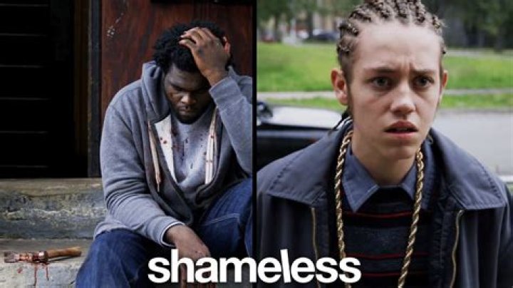 Was Carl's Broken Leg On Shameless Real?