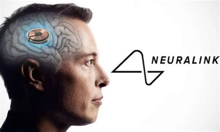 Was Neuralink's first human brain chip implant successful? Find out as Elon Musk shares major update