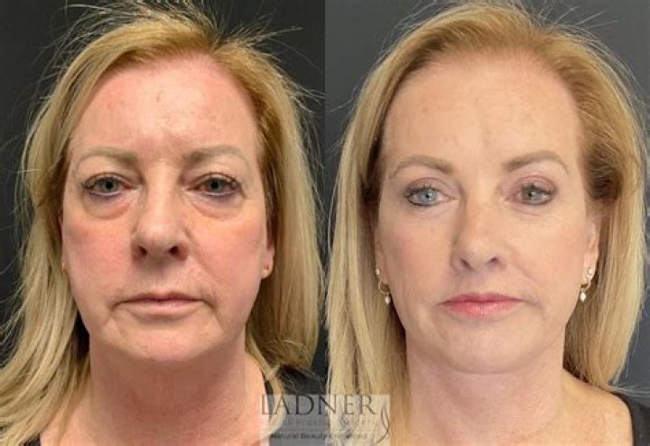 We lift the lid on new trend for designer vaginas — and why so many women dissatisfied with their privates are choosing to have cosmetic surgery