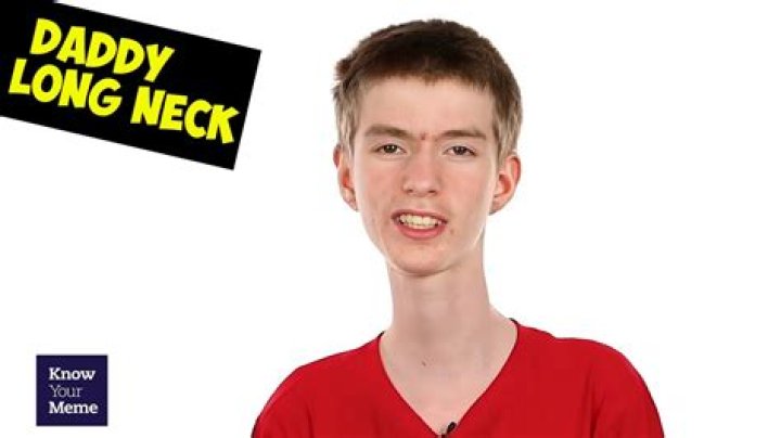 What's wrong Daddy Long Neck? Wiki, disease, age, net worth