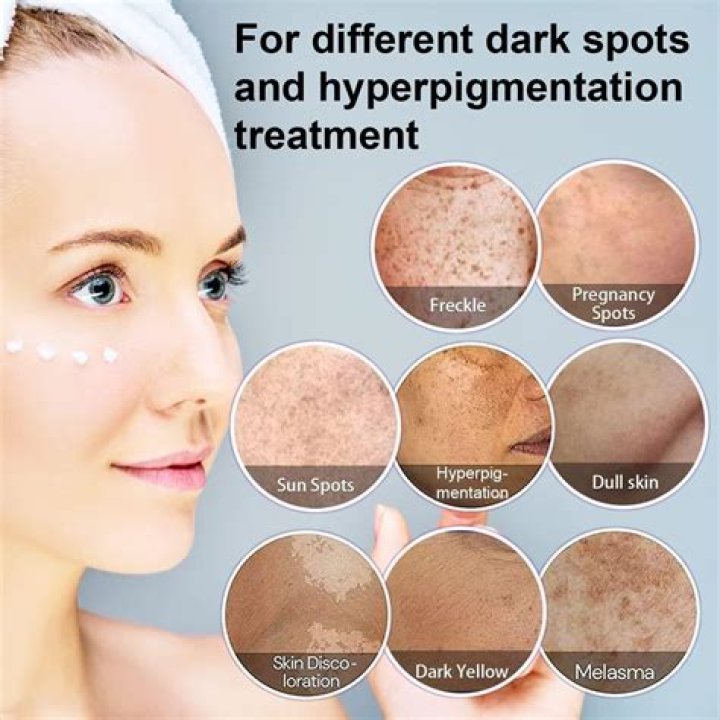 What Are Those Black Spots on Your Vag Lips?
