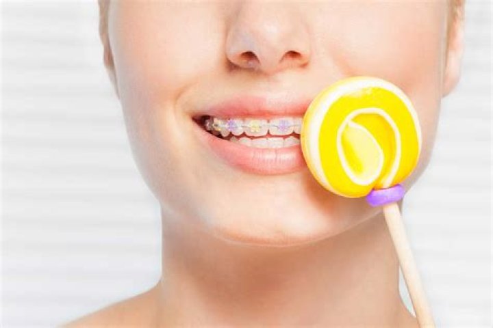 What candies break braces?