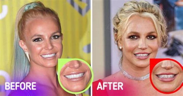 What happened to Britney Spears' teeth? Exploring rumors about the pop star's dental appearance amid controversial new Instagram post