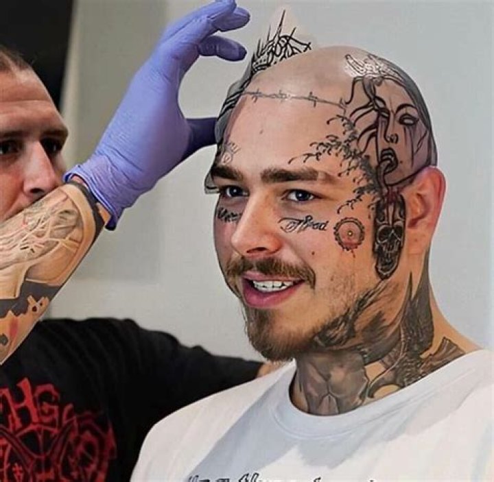 What Happened To Fousey Hair Tattoo’s Head and Face?
