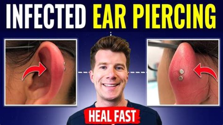 What Happens To A Piercing Once It's Removed? Here's What To Do To Minimize Scarring