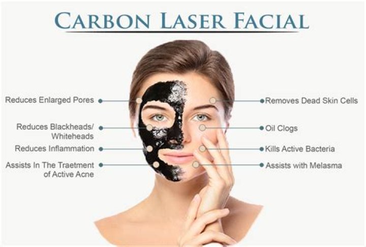 What is a carbon laser facial, what are the benefits of the charcoal peel rejuvenation and which celebrities use them?